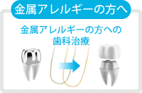 金属アレルギーの方へ